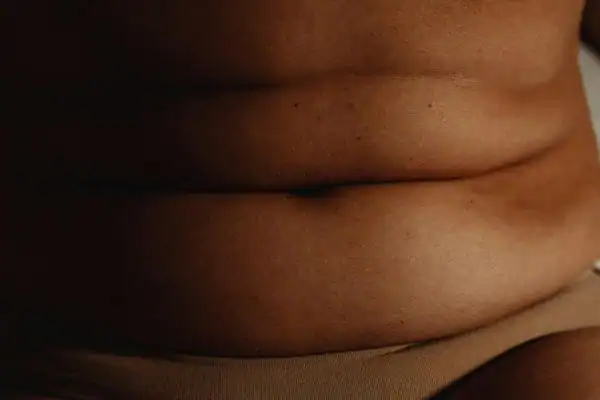 The Hidden Connection: How Stress Shapes Your Fitness and Body Composition 3 image of what stress can do on the stomach area and how Lipo 360 Hillingdon can help to change your body shape.